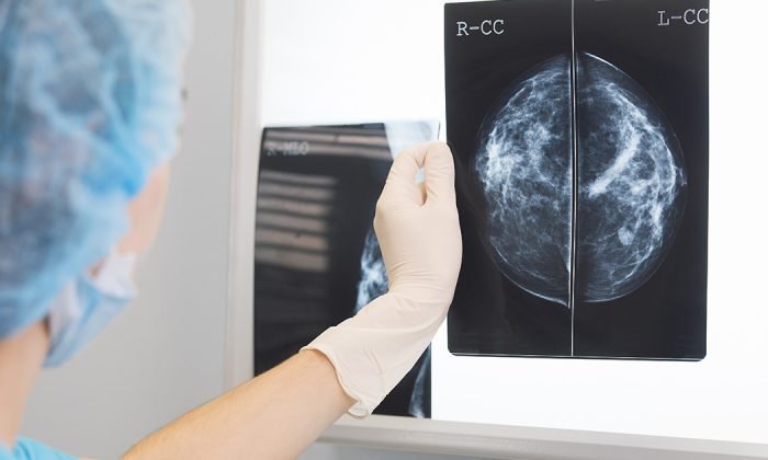 Teste em Aparelho de Mamografia Digital